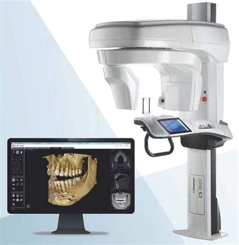 Cone beam computed tomography .